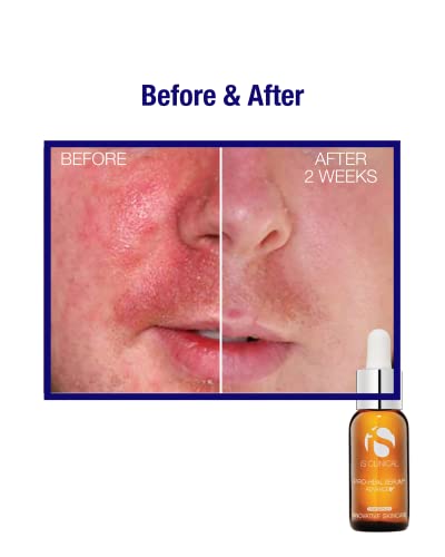 Pro-Heal Serum Advance+ Antioxidant-rich Vitamin C Serum, Vitamin E And Retinol For Redness, Rosacea And Inflammation