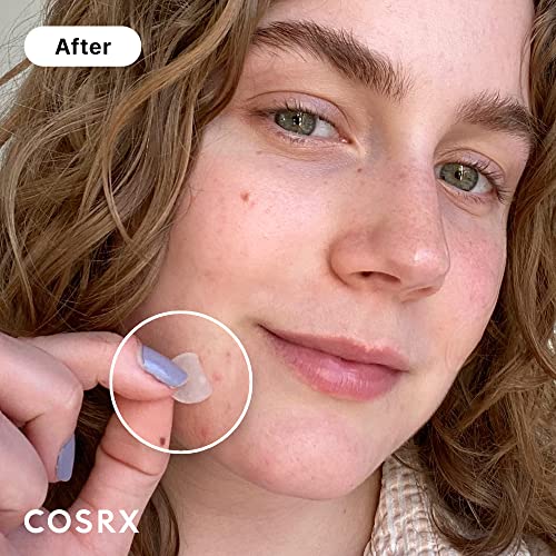 COSRX Acne Pimple Patch (96 Counts)